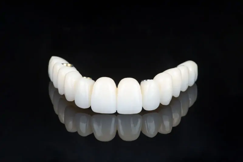 Prótese PF1 fixa sobre implantes